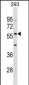 IFIT2 Antibody (Center)